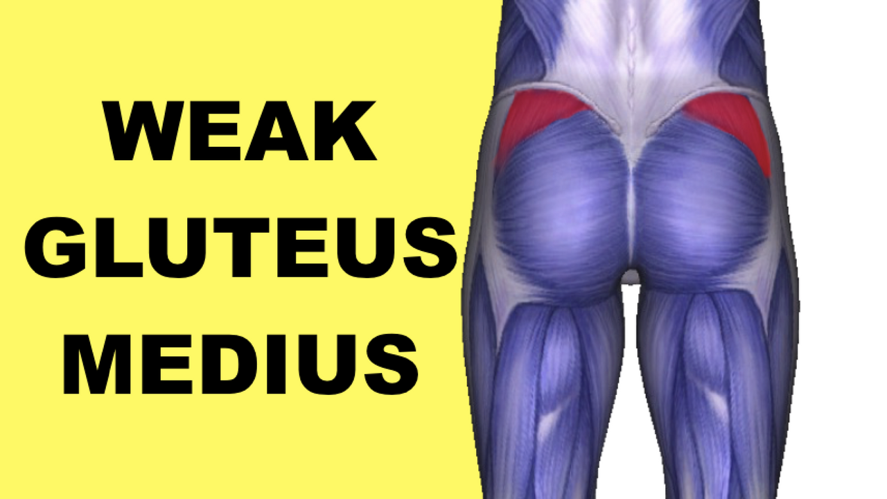Patellar Tendonitis Exercises Stretches How Weak Glutes Medius