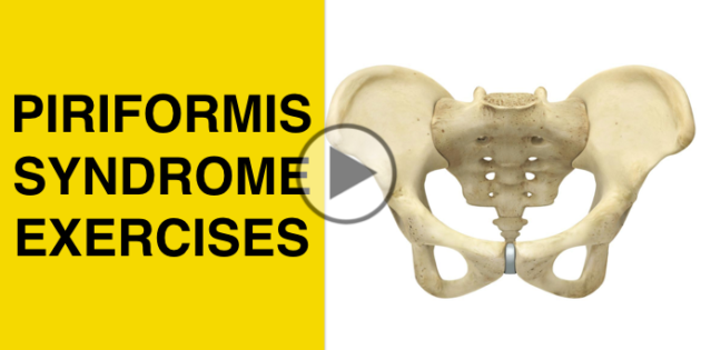 piriformis syndrome exercises & stretches