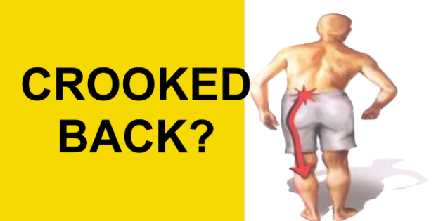 Herniated Disc Causing Crooked Back? Do This For Sciatic Nerve Pain Relief (Antalgic Lean)