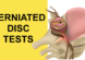 sciatica causes herniated disc test