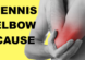 tennis elbow cause test lateral epicondylitis